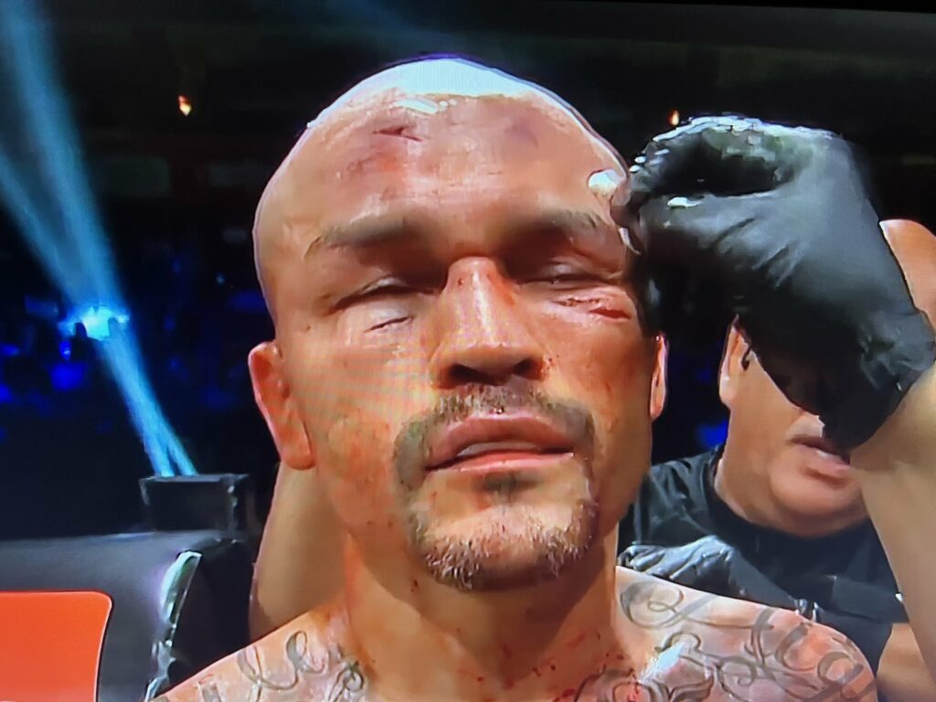Mike Alvarado had a couple of cuts on his head after two rounds in his BKFC debut 