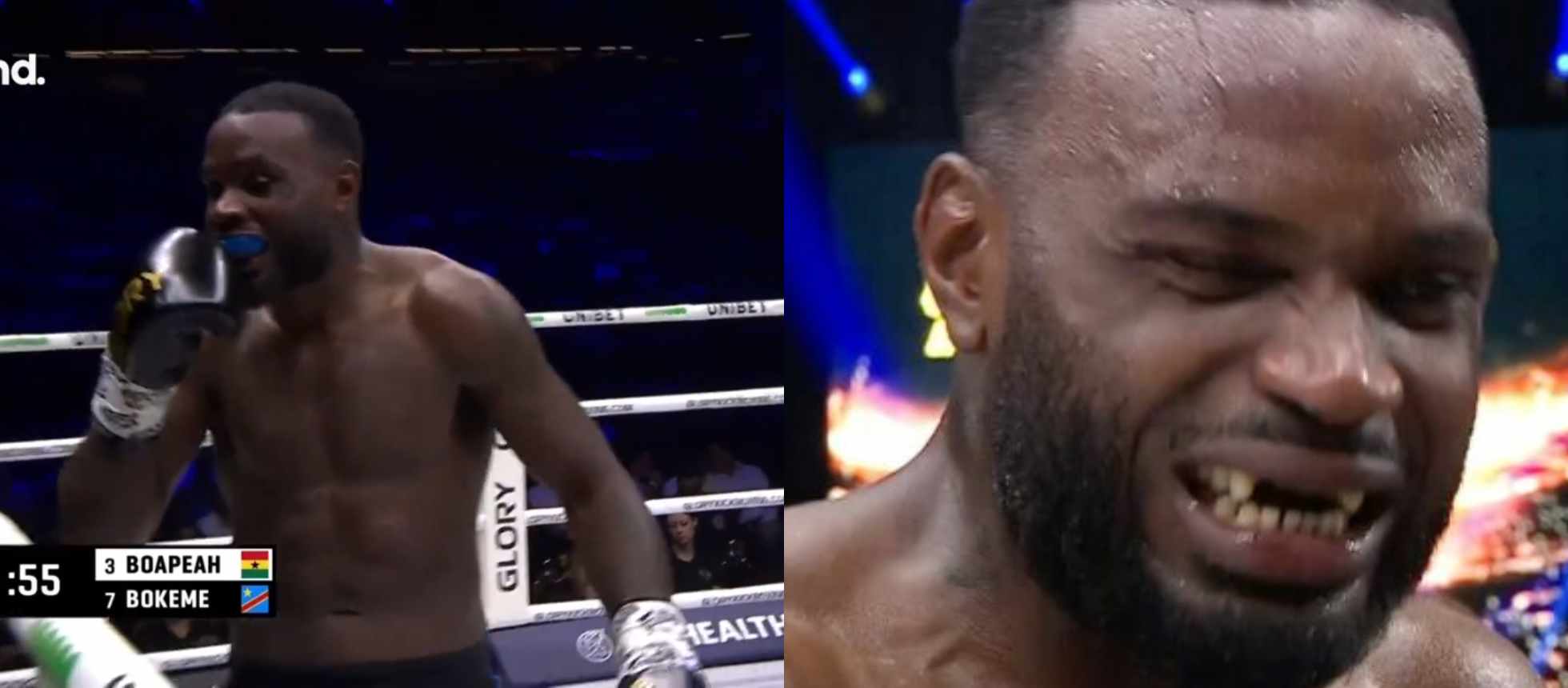 (Video) Kickboxer loses front teeth from impact during Glory event