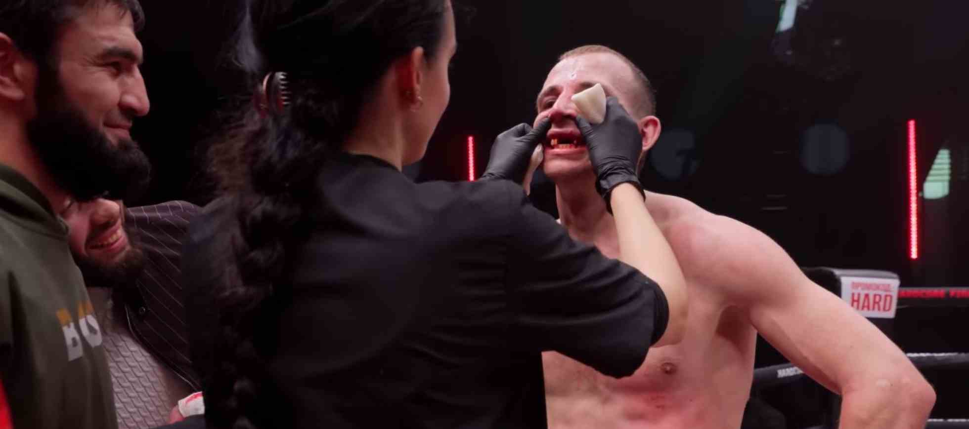 Bare-Knuckle Boxing Match Turns Gruesome as star Loses Front Teeth